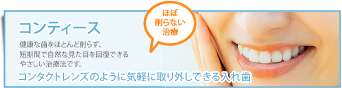 コンティースバナー