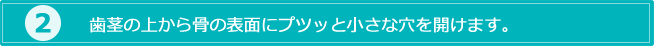 2.歯茎の上から骨の表面にプツッと小さな穴を開けます。