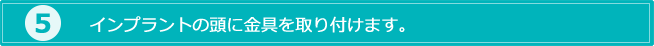5.インプラントの頭に金具を取り付けます。