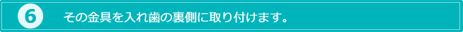 6.その金具を入れ歯の裏側に取り付けます。