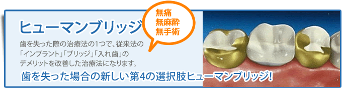 ホワイトニング 歯の色でお悩みではありませんか？歯を削る事無く薬剤で安全にホワイトニングが可能です。　気軽におしゃれ感覚でホワイトニング